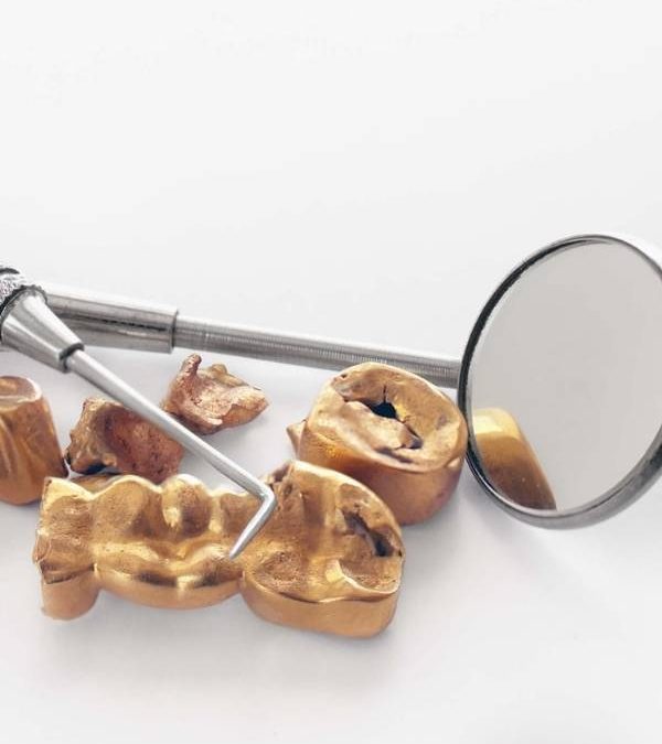 How Much Gold Is in a Dental Crown